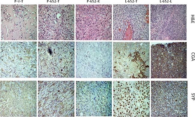 Expression of CGA and SYP in xenografted tumors and metastases from PC3-652 and LNCaP-652 cells.