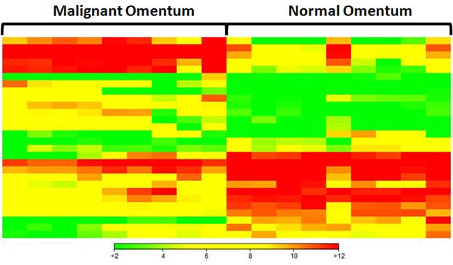 Hierarchical clustering analysis of top 20 up-regulated and top 20 down-regulated miRNAs in omental metastases.