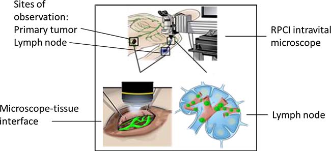 Schematic of ongoing clinical trial (NCT02857374), which is investigating the microvasculature associated with the primary tumor and the sentinel lymph node (SLN) of patients with melanoma who meet criteria for SLN biopsy.