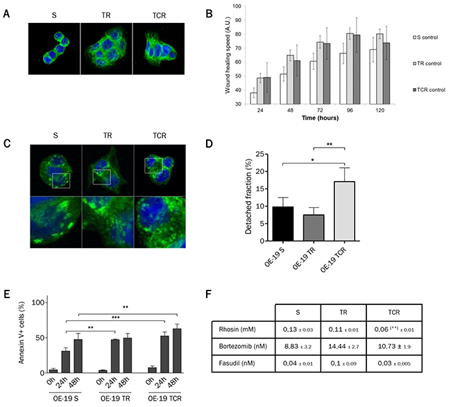 Morphology is modified in both resistant cell lines but only TCR cells have increased migration speed and decreased adhesion strength.