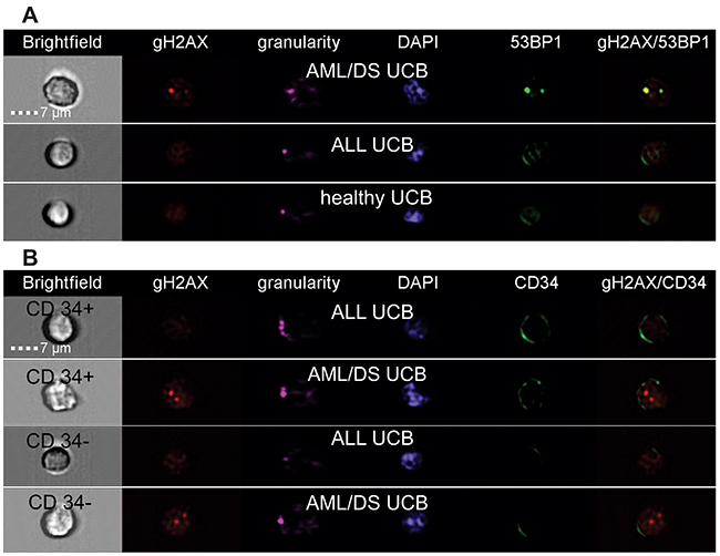 Representative images of cells from healthy and patient&rsquo;s UCB obtained by imaging flow cytometry.