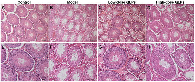 Histological changes in the rat testes.