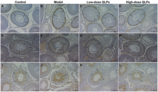 Expression and location of apoptosis-related proteins in testis tissue.