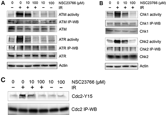 Rac1 inhibition abolishes IR-induced activation of both ATM and ATR signaling pathways.