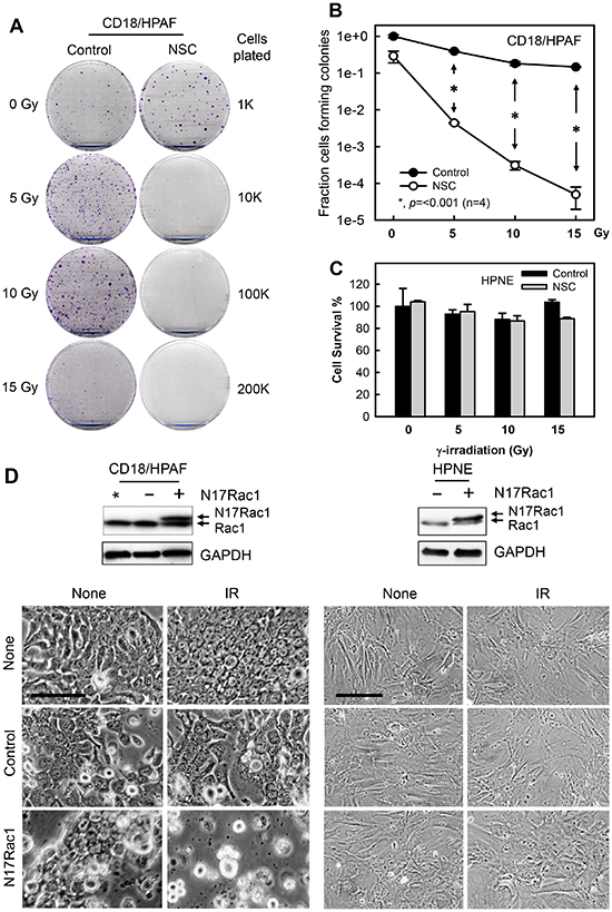 Inhibition of Rac1 abrogates clonogenic survival of irradiated pancreatic cancer cells.