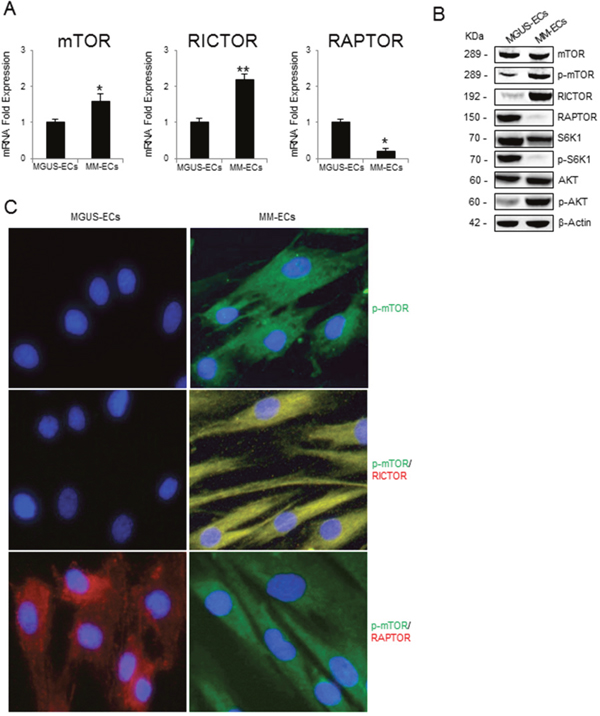 mTOR expression and mTOR activation pathway in MGUS-ECs and MM-ECs.