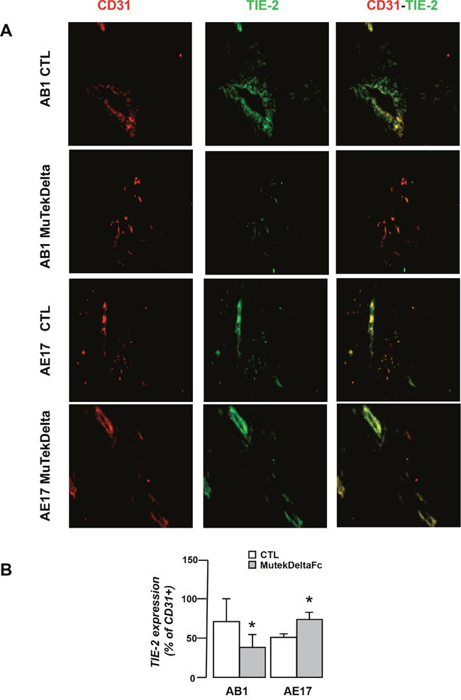 Murine Tek-Delta Fc differentially affects Tie-2 expression by AB1 and AE17 tumor vasculature.