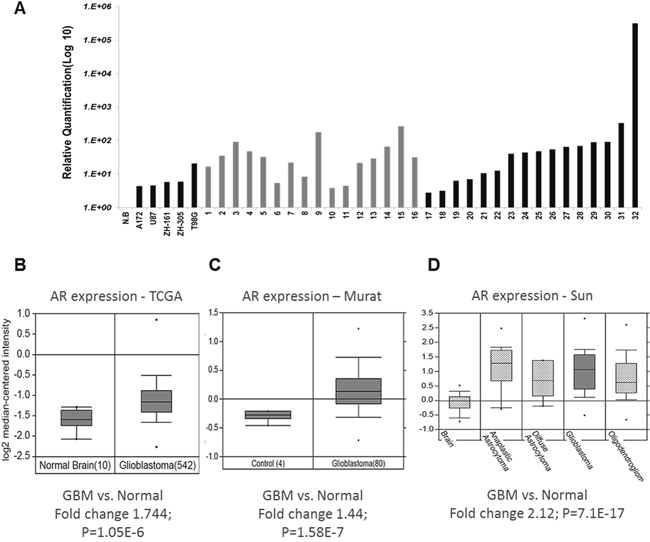 AR RNA expression in GBM tissue samples.