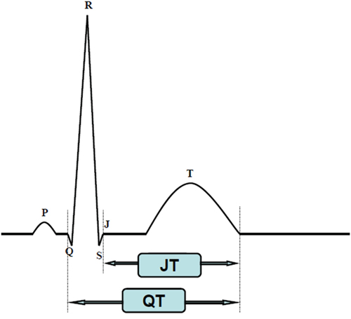 QT and JT interval measurement with ECG.
