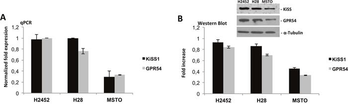 Expression analysis of KiSS1/GPR54 system in mesothelioma cell lines.