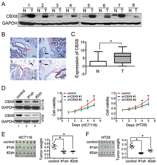 CBX8 was up-regulated and essential for growth in human colorectal cancer.