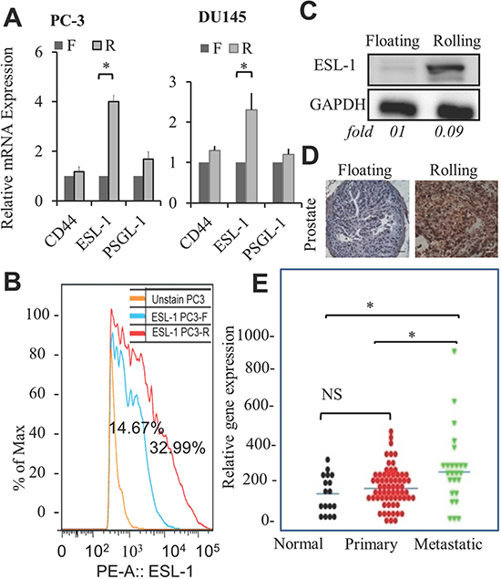 Elevation of ESL-1 in rolling PCa cells, tumors, and human metastatic tissue samples.