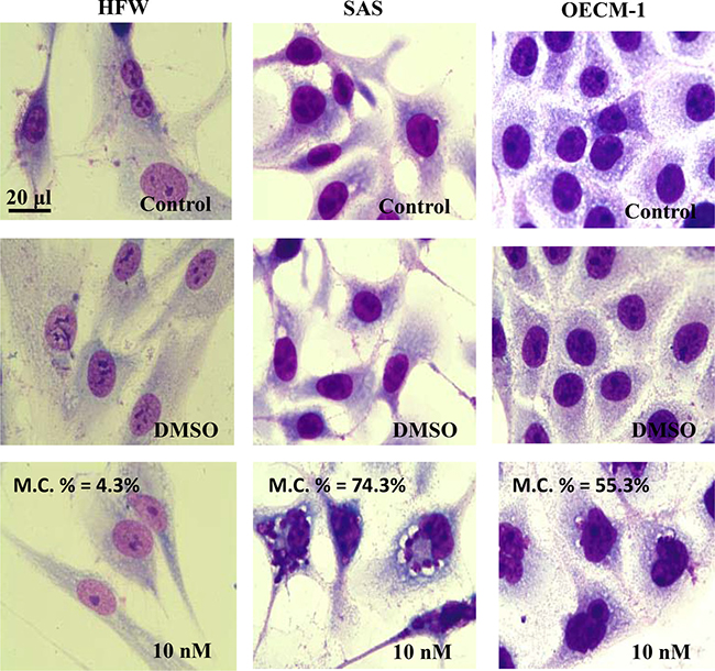 Morphology of HFW, SAS, and OECM-1 cells treated with BI2536.