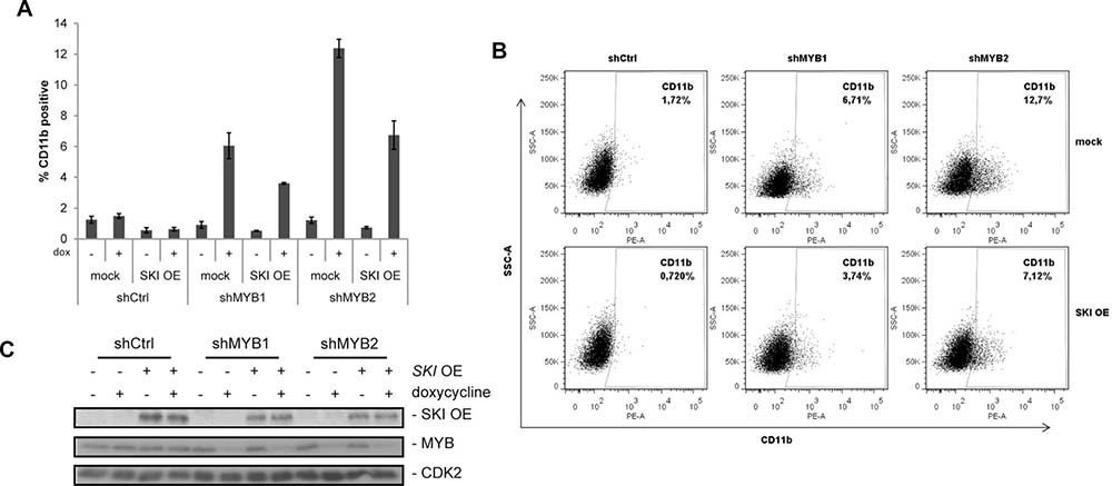 SKI overexpression attenuates MYB dependent differentiation in AML cells.