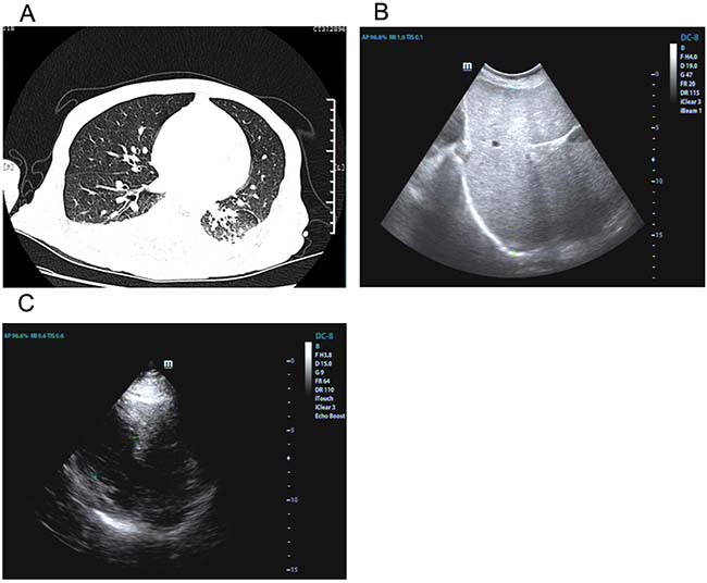 Imaging findings of lung, liver and heart.
