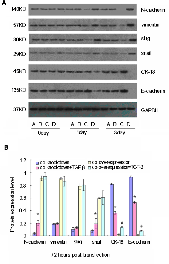 Western blot analyses of relative expression levels of epithelial-mesenchymal transition (EMT)-related genes in cancer stem cells (CSC) following simultaneously modulation of Oct-4 and Nanog expression and TGF-&#x03B2; stimulation in vitro.