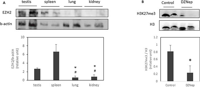 EZH2 expression and H3K27 trimethylation in several tissues.