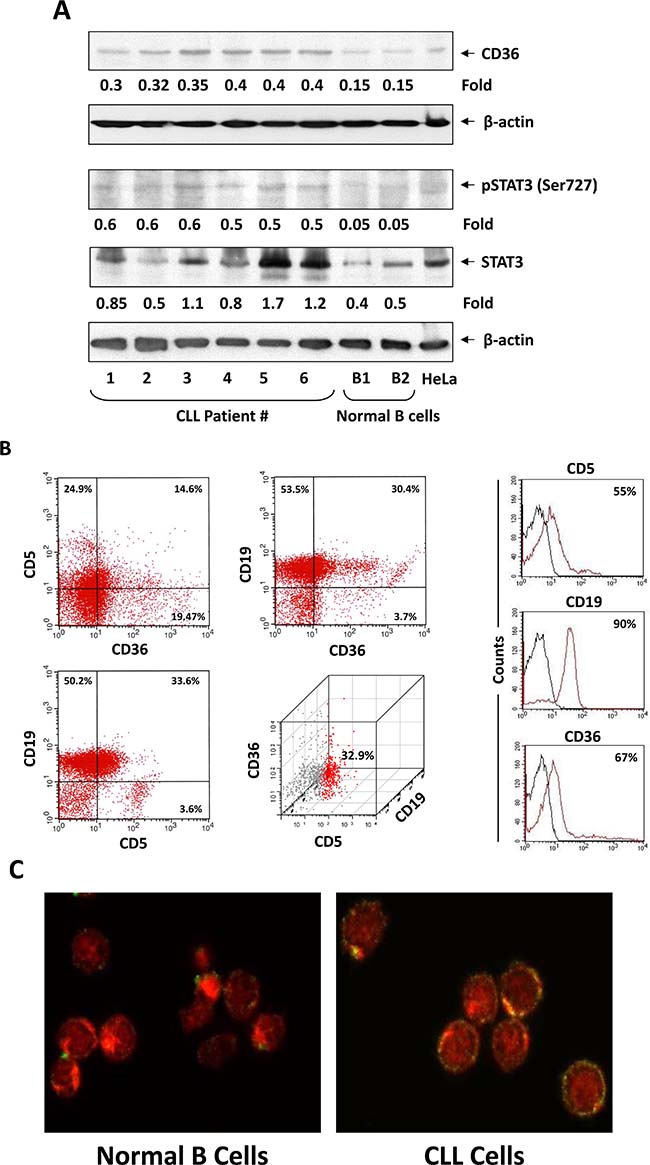 CLL cells express high levels of CD36.