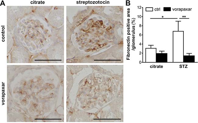 Limited glomerular fibronectin deposition upon vorapaxar treatment in STZ-induced diabetic mice.