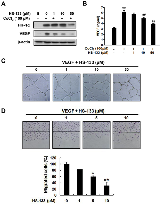 Effect of HS-133 on angiogenesis of SkBr3 cells and HUVECs.