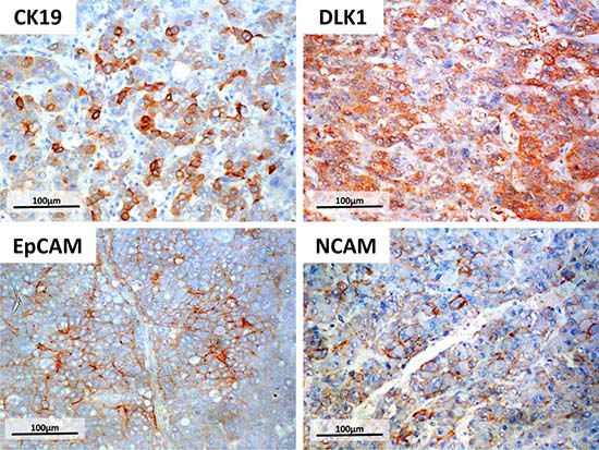 Immunohistochemistry of four HPC markers.