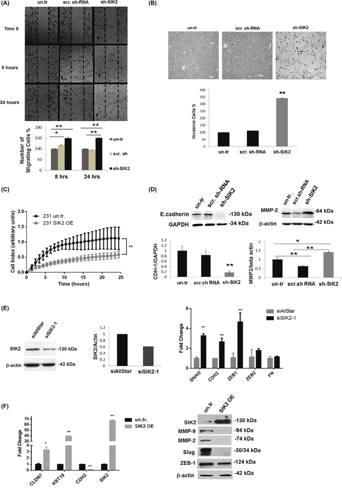 SIK2 inhibits migration and invasion of breast cancer cell lines via blocking EMT.