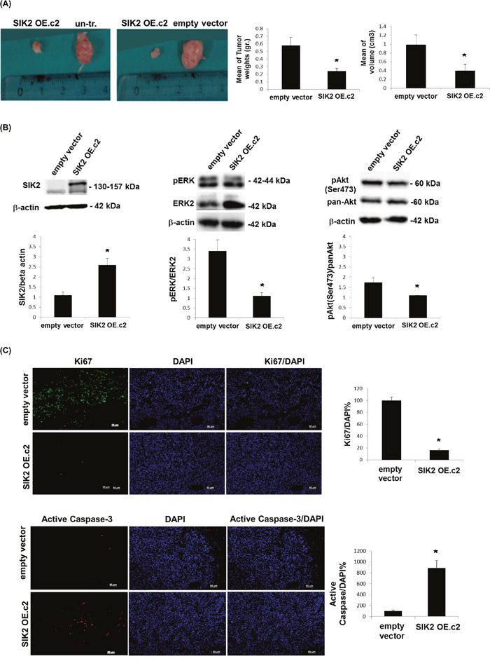 Attenuation of tumor growth by SIK2 is accompanied with simultaneous inhibition of MAPK and PI3K/Akt signaling pathways.