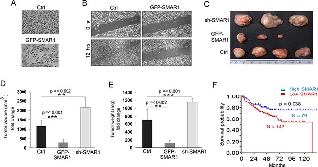 SMAR1 inhibits CRC cell migration and invasion.