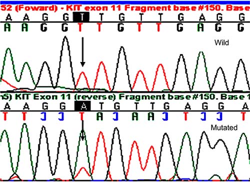 Chromatogram showing mutation in exon 11 of the gene KIT/L576P of a representative case (case 26).