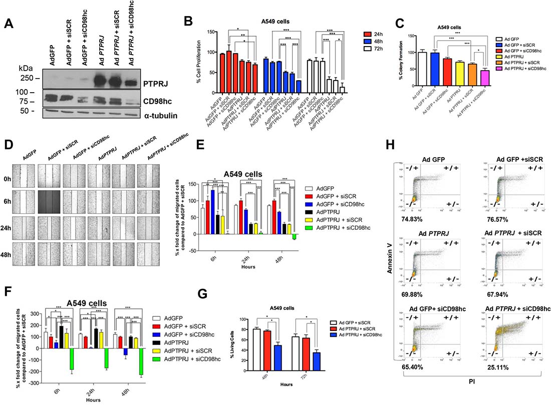 PTPRJ overexpression synergizes with CD98hc silencing in decreasing proliferation and migration of cells A549 and effectively triggers their programmed cell death.