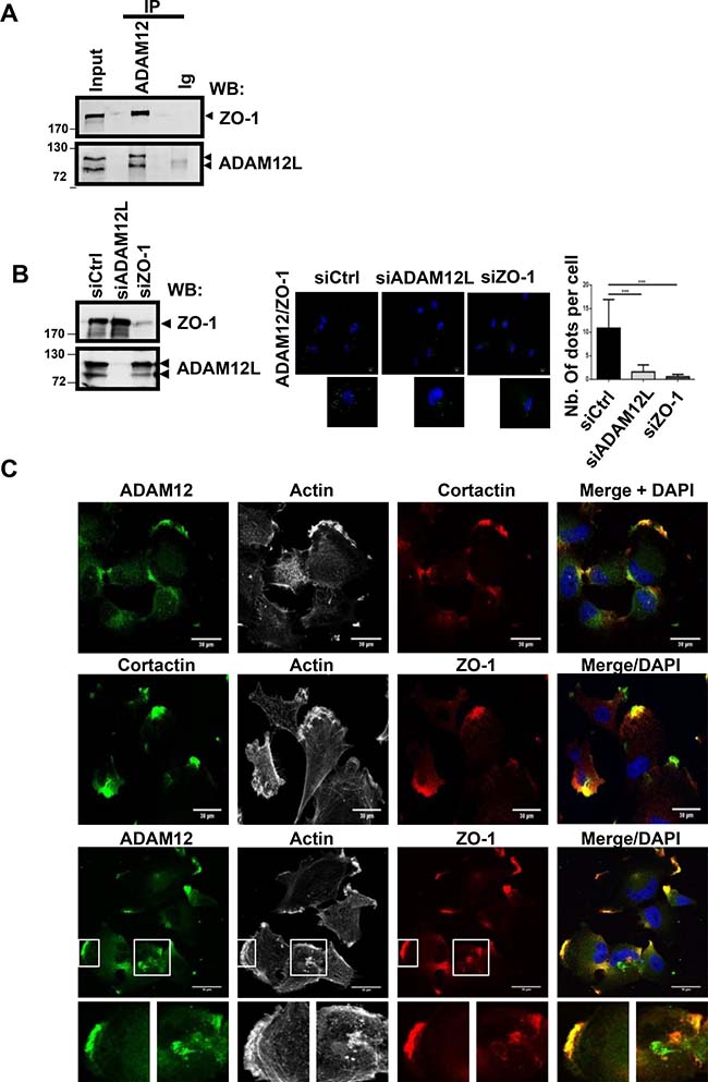 ADAM12L interacts and co-localizes with ZO-1 in breast cancer cell line HS578T.