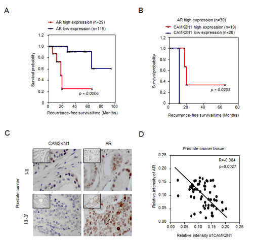 A significant negative correlation between CAM2KN1 and AR in prostate cancer specimens.