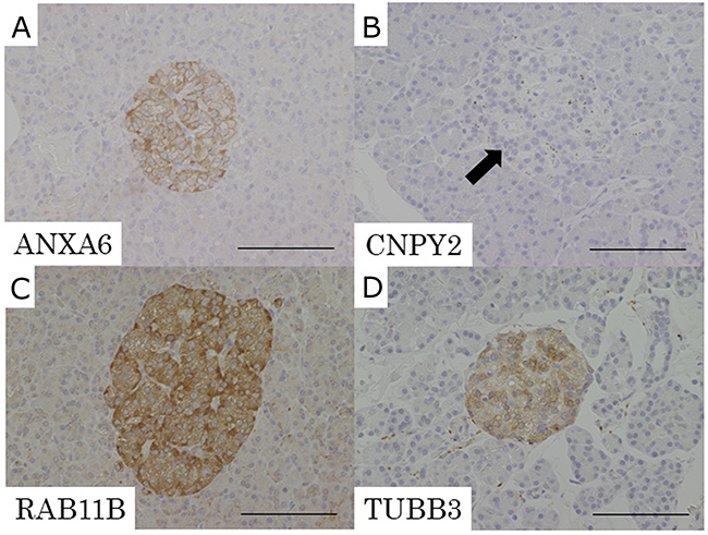 Representative pictures of IHC for the candidate proteins in normal pancreatic tissue.