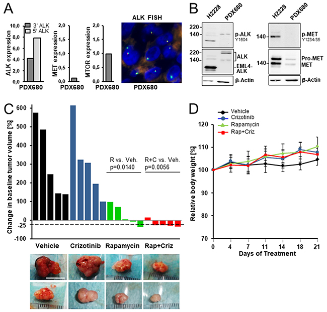 Preclinical efficacy of rapamycin, crizotinib and combined treatment in a mesothelioma xenograft model.