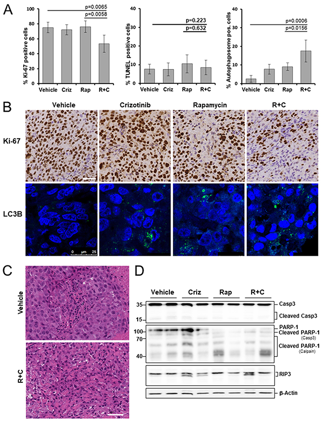 Effects of rapamycin, crizotinib and combined treatment on cell proliferation, apoptosis and autophagy in a mesothelioma xenograft model.