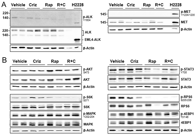 Effect of ALK/MET inhibitor crizotinib and mTOR inhibitor rapamycin on downstream signaling pathways in a mesotheliom xenograft model.