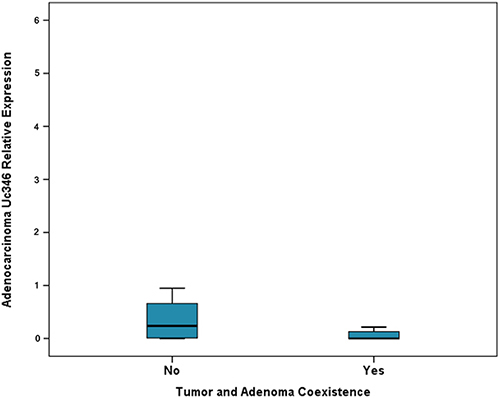 Relative expression of Uc346 in adenocarcinomas and adenocarcinoma and adenoma coexistence.