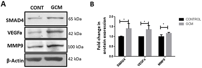SMAD4 and tumor supportive genes MMP9 and VEGFa are upregulated in glioma associated microglia.