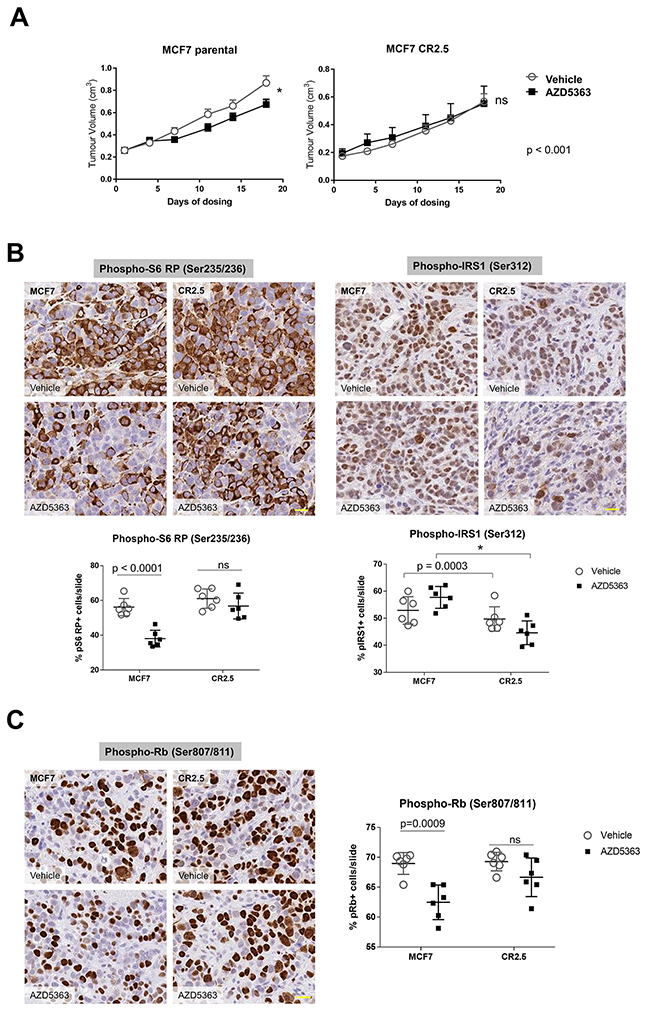 MAP3K1-deficient tumors are resistant to AZD5363 treatment.