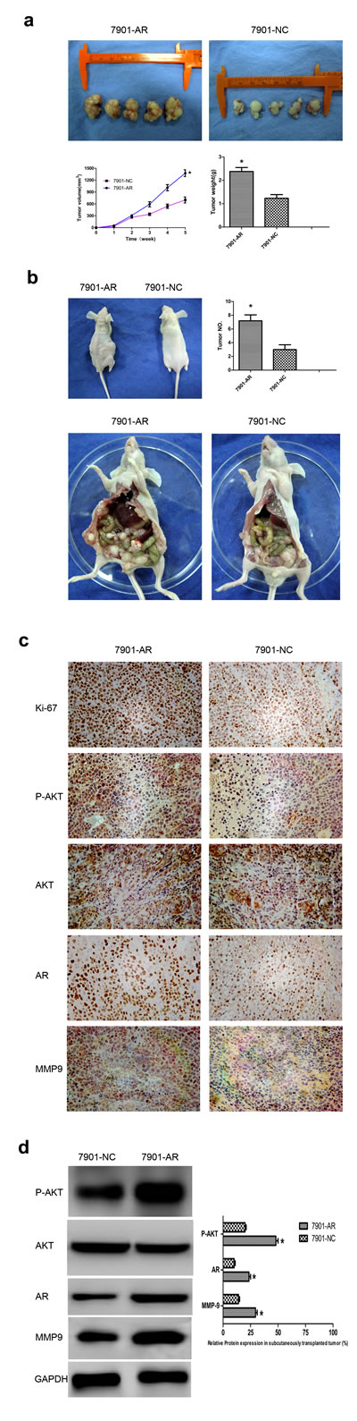 Fig.6: Overexpression of AR promotes tumor growth and migration