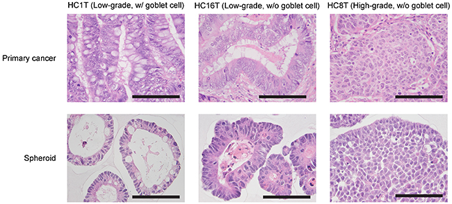 Histological characterization of patient-derived CRC-TIC spheroids.