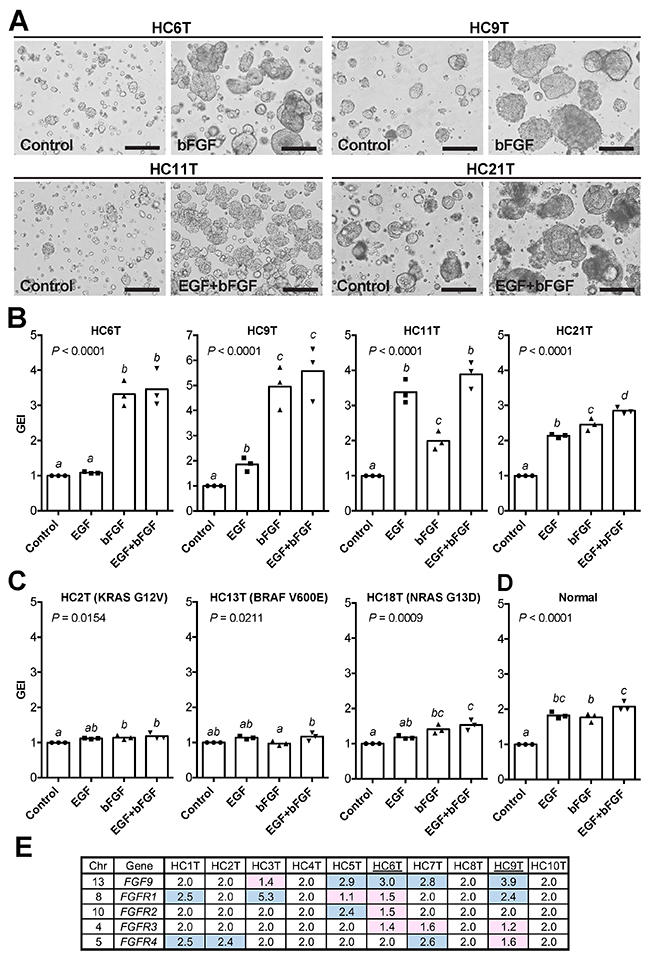 Growth-promoting effects of EGF and bFGF on CRC-TIC spheroids.