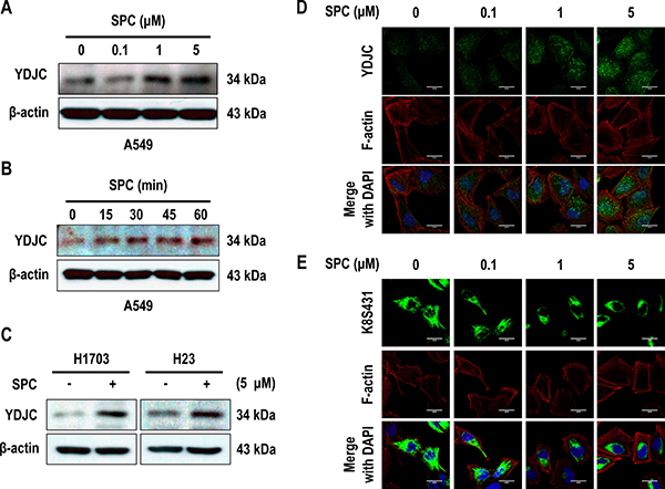 SPC induces YDJC expression in lung cancer cells.