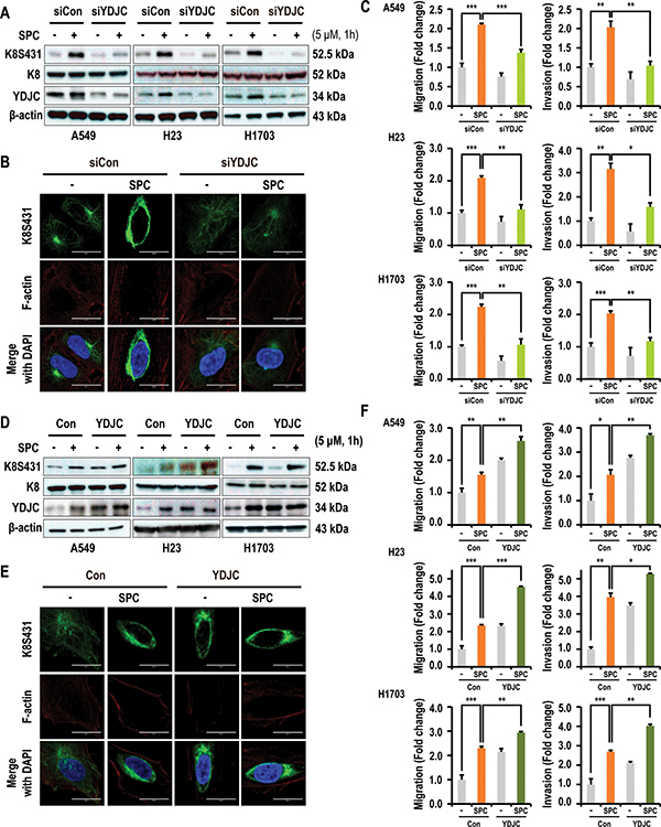 YDJC is involved in the SPC-induced K8 phosphorylation and reorganization of A549 cells.