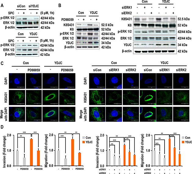 Effects of deacetylase activity of YDJC on phosphorylation and reorganization of K8.