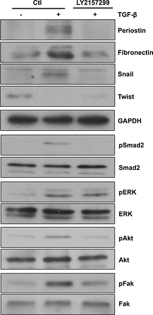 Galunisertib alters TGF-&#x03B2;-induced EMT markers, Smad2, Akt and Fak signaling pathways.