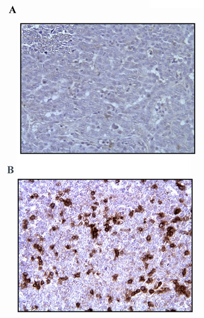 Fig.3: T Cells Infiltration of Mammary Tumor After p62 Vaccination.
