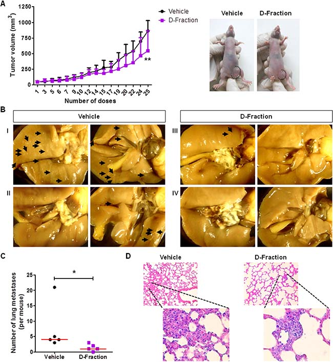 Maitake D-Fraction retards tumor growth and reduces the number of lung metastases in a xenograft model of TNBC human cells.