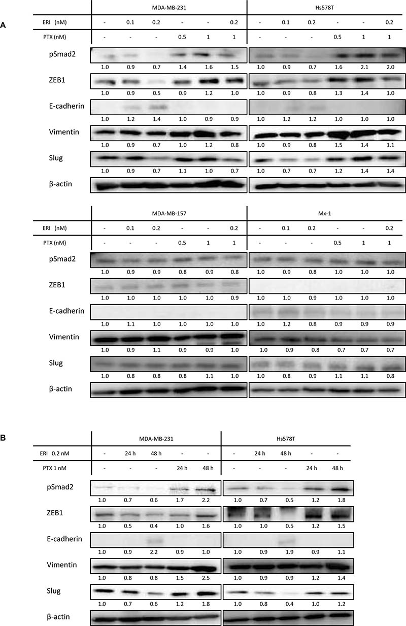 Expression of epithelial/mesenchymal markers in triple-negative breast cancer (TNBC) cell lines.