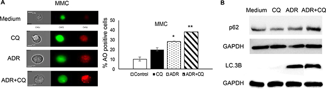 CQ blocks ADR-induced autophagy.